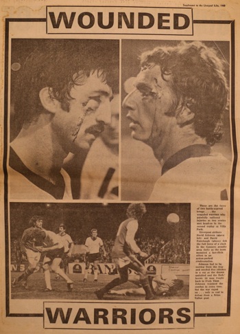 Wounded warriors: Johnson and Fairclough